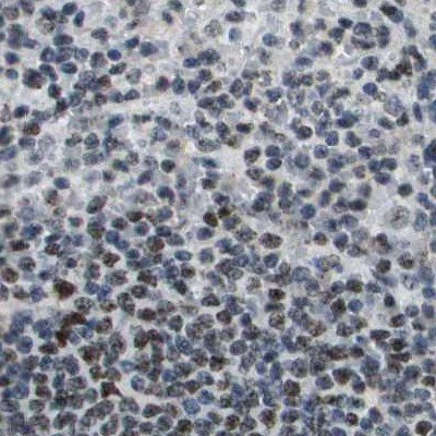 SP100 Antibody in Immunohistochemistry (IHC)