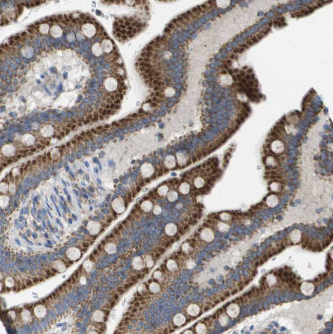 FIS1 Antibody in Immunohistochemistry (IHC)