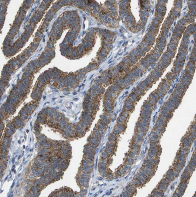 FIS1 Antibody in Immunohistochemistry (IHC)