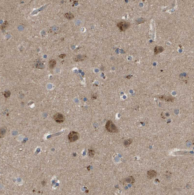 FIS1 Antibody in Immunohistochemistry (IHC)