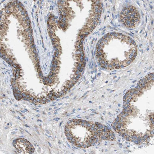 FIS1 Antibody in Immunohistochemistry (IHC)