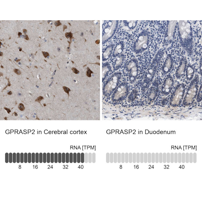 GPRASP2 Antibody in Immunohistochemistry (IHC)