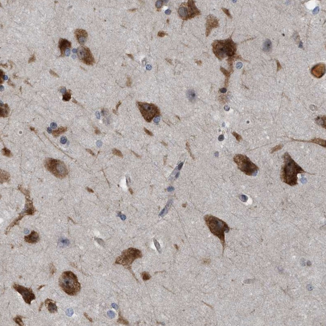 GPRASP2 Antibody in Immunohistochemistry (IHC)