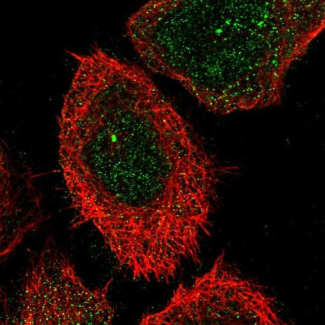 CHST15 Antibody in Immunocytochemistry (ICC/IF)