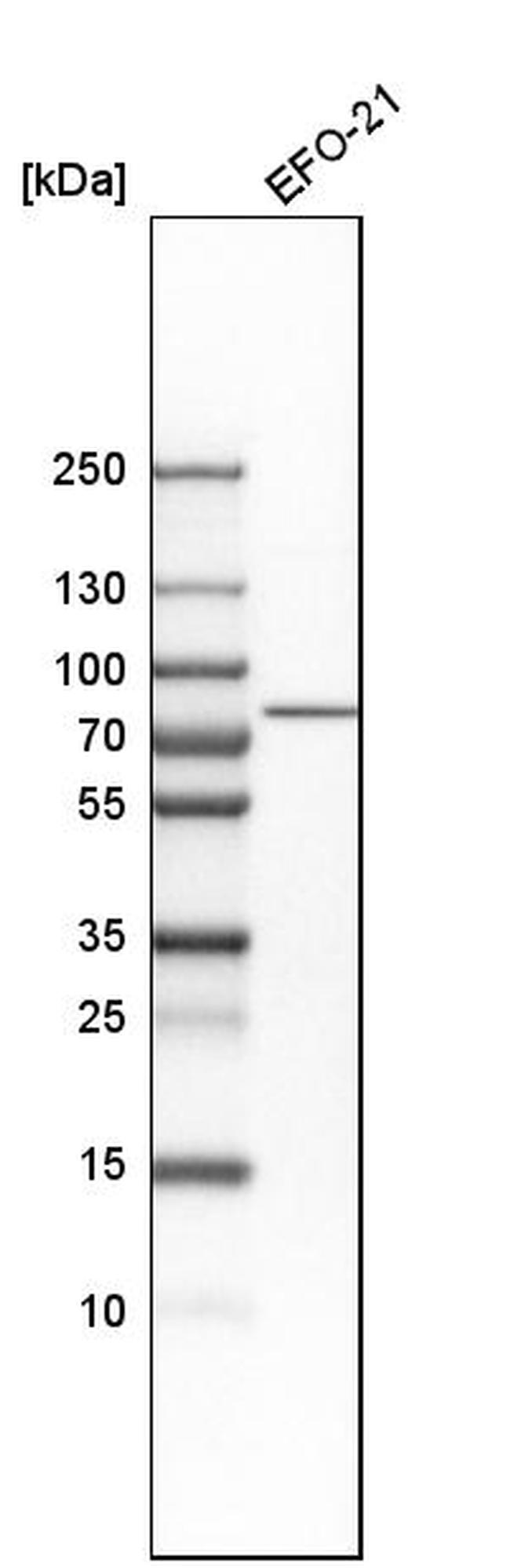 DNAJC14 Antibody in Western Blot (WB)
