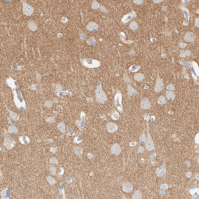 ATCAY Antibody in Immunohistochemistry (IHC)