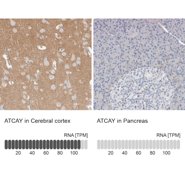 ATCAY Antibody