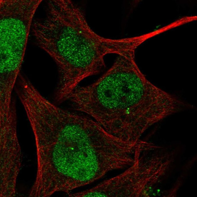 ZBTB24 Antibody in Immunocytochemistry (ICC/IF)