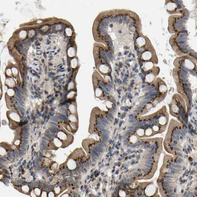 YIPF4 Antibody in Immunohistochemistry (IHC)