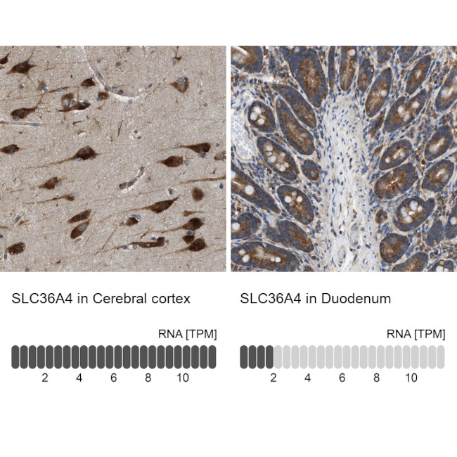 SLC36A4 Antibody in Immunohistochemistry (IHC)