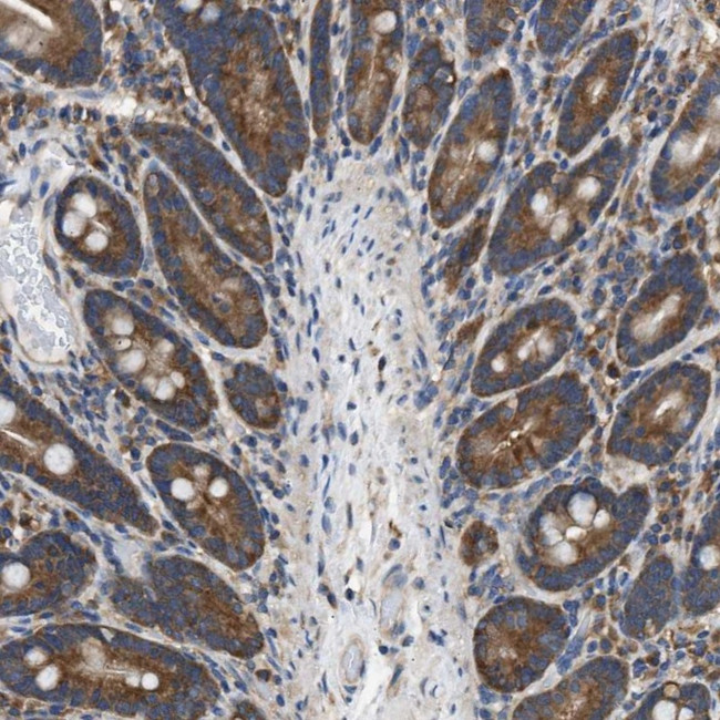 SLC36A4 Antibody in Immunohistochemistry (IHC)