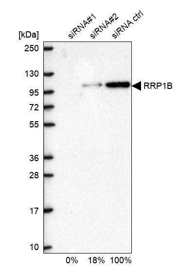 RRP1B Antibody