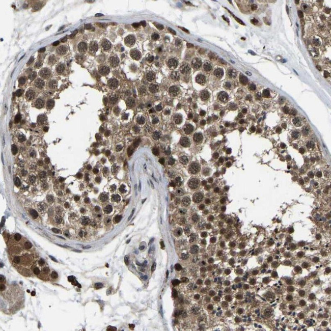 RRP1B Antibody in Immunohistochemistry (IHC)