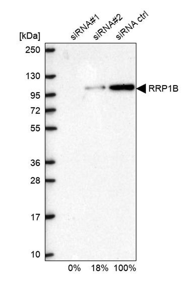 RRP1B Antibody in Western Blot (WB)