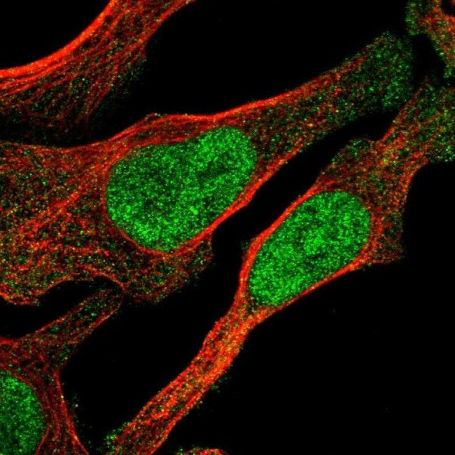 OGFR Antibody in Immunocytochemistry (ICC/IF)