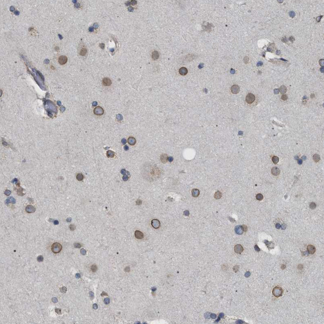 NUP93 Antibody in Immunohistochemistry (IHC)