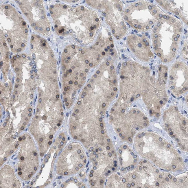 NUP93 Antibody in Immunohistochemistry (IHC)