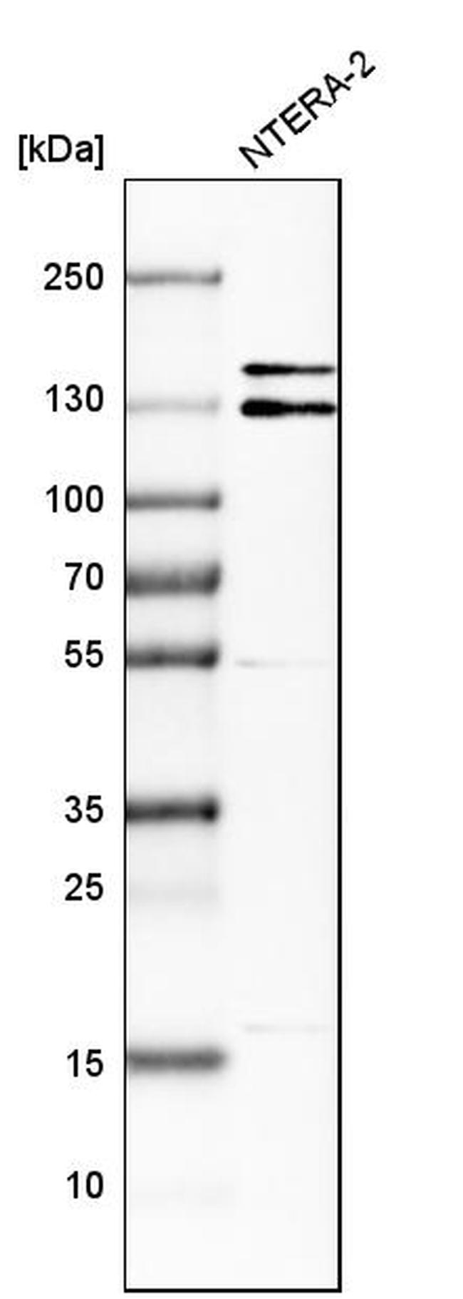 ITSN1 Antibody in Western Blot (WB)