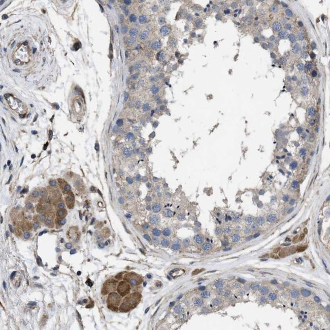 SQLE Antibody in Immunohistochemistry (IHC)