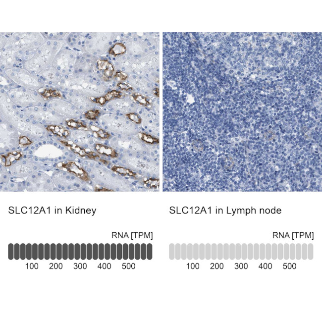 NKCC2 Antibody in Immunohistochemistry (IHC)