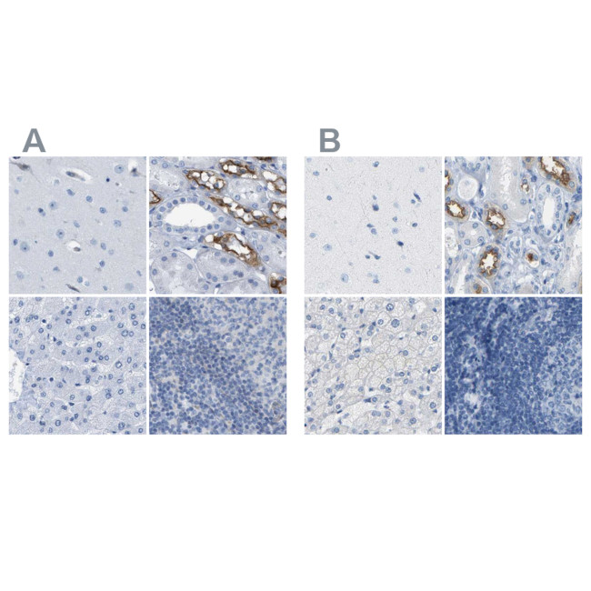 NKCC2 Antibody in Immunohistochemistry (IHC)