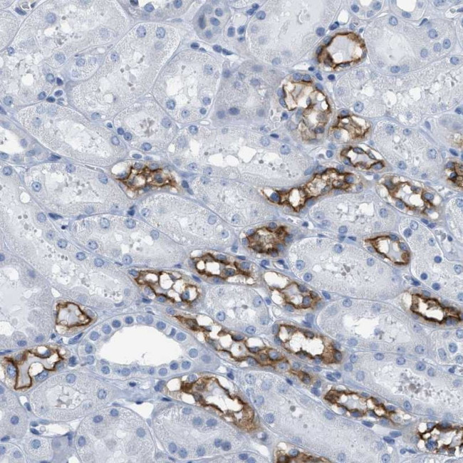 NKCC2 Antibody in Immunohistochemistry (IHC)