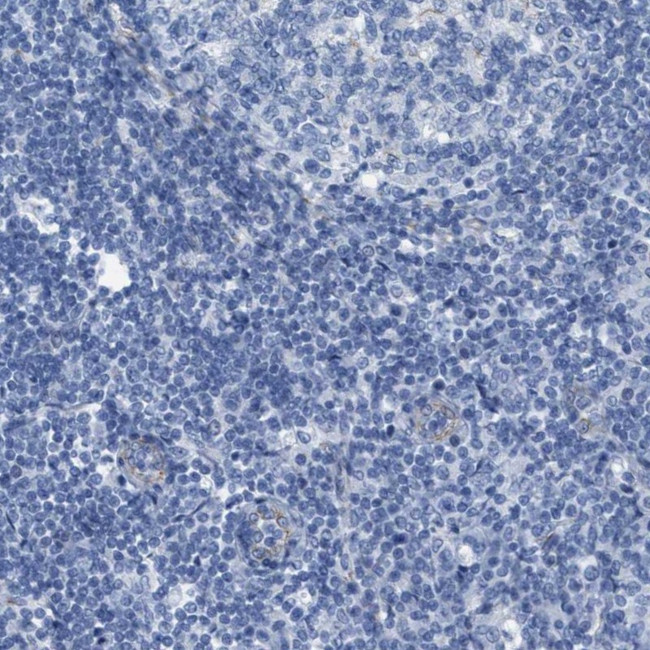 NKCC2 Antibody in Immunohistochemistry (IHC)