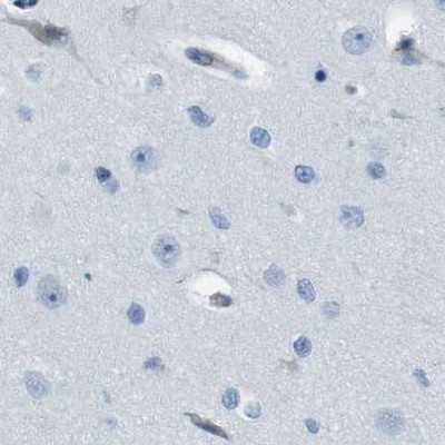 NKCC2 Antibody in Immunohistochemistry (IHC)