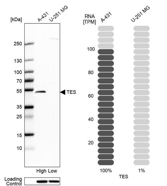 TES Antibody in Western Blot (WB)