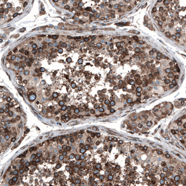 GPIP137 Antibody in Immunohistochemistry (IHC)