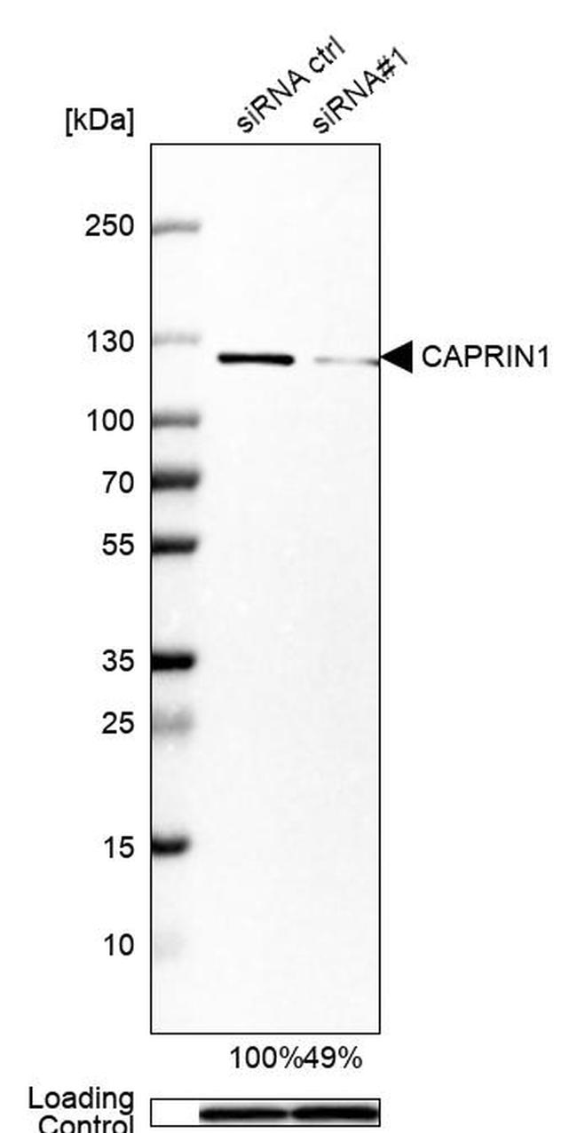 GPIP137 Antibody in Western Blot (WB)