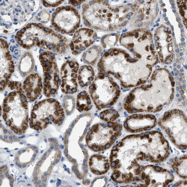 ILDR1 Antibody in Immunohistochemistry (IHC)