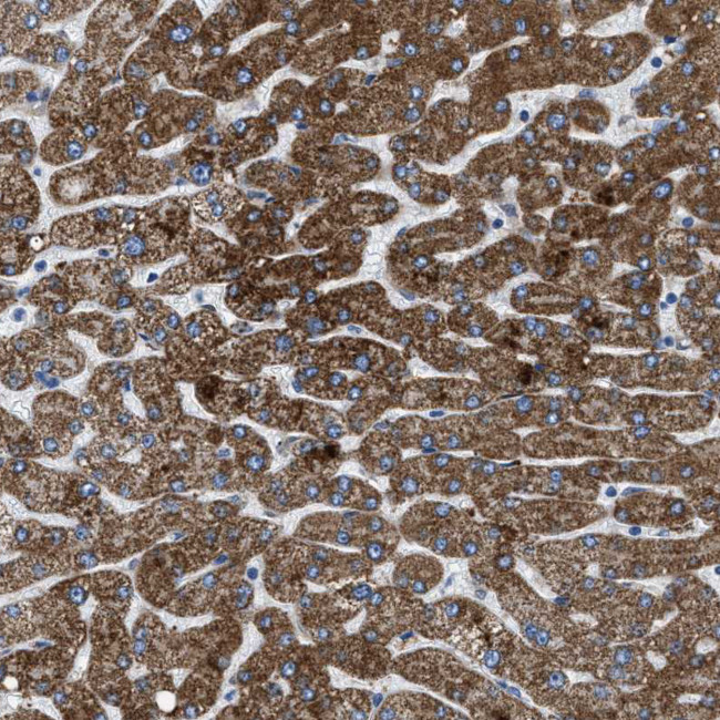 ILDR1 Antibody in Immunohistochemistry (IHC)