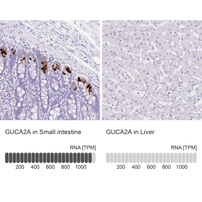 GUCA2A Antibody in Immunohistochemistry (IHC)