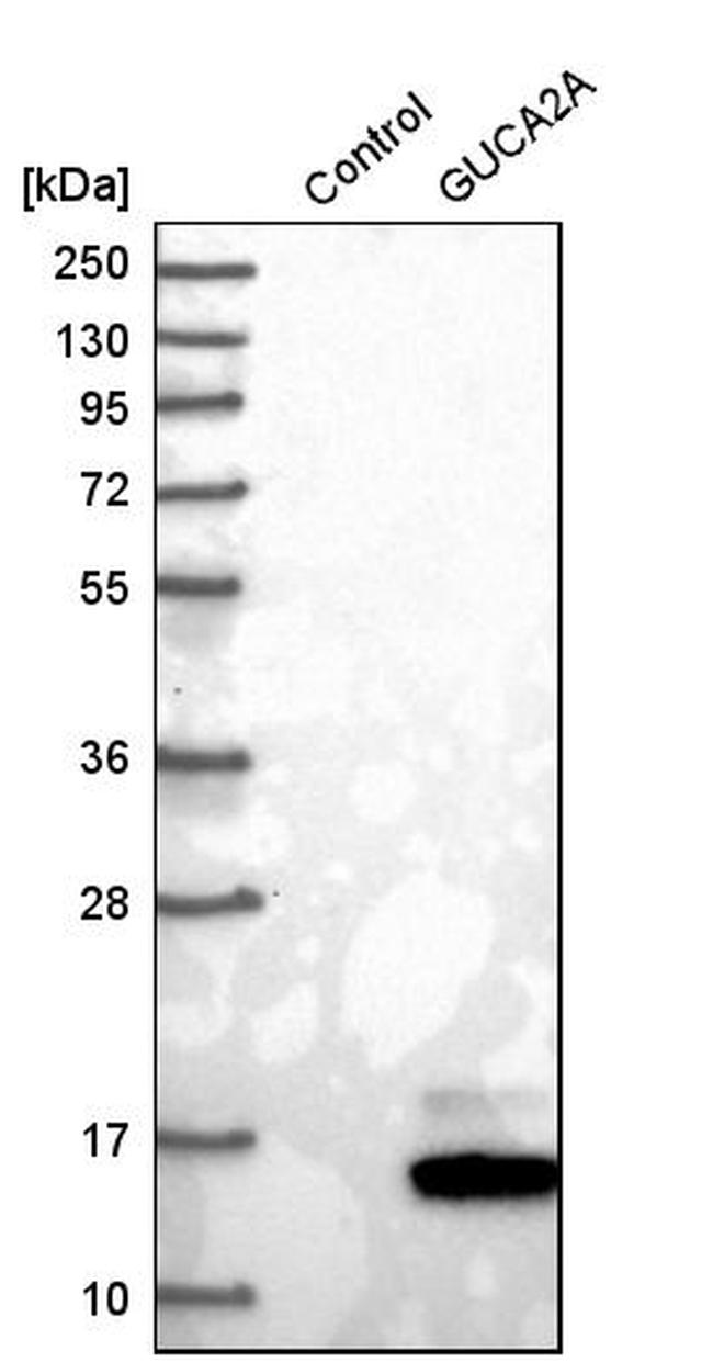 GUCA2A Antibody in Western Blot (WB)