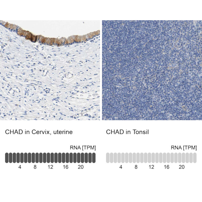 CHAD Antibody in Immunohistochemistry (IHC)