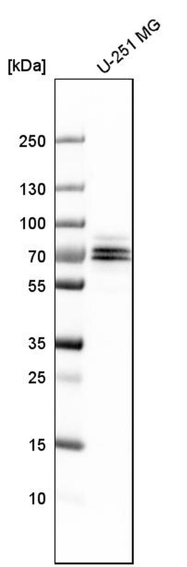 FXR1 Antibody in Western Blot (WB)