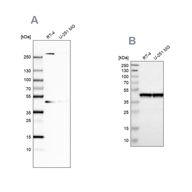 SMARCB1 Antibody in Western Blot (WB)