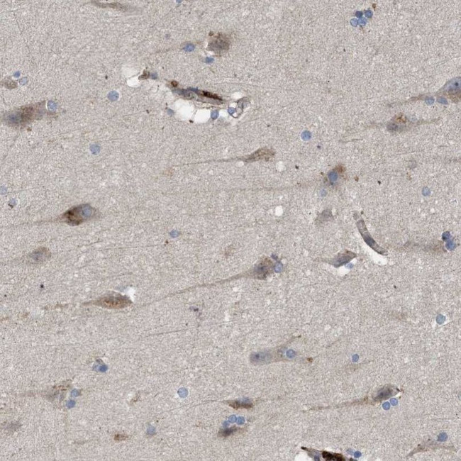 ARHGEF4 Antibody in Immunohistochemistry (IHC)