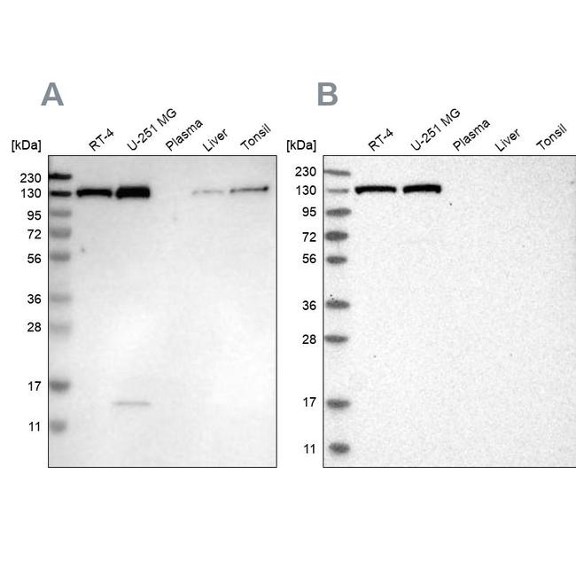 XPO5 Antibody in Western Blot (WB)