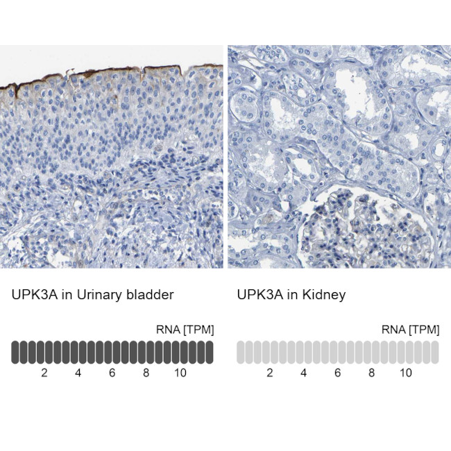 UPK3A Antibody in Immunohistochemistry (IHC)