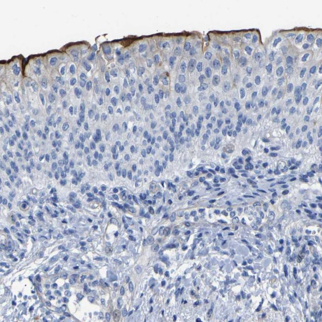 UPK3A Antibody in Immunohistochemistry (IHC)