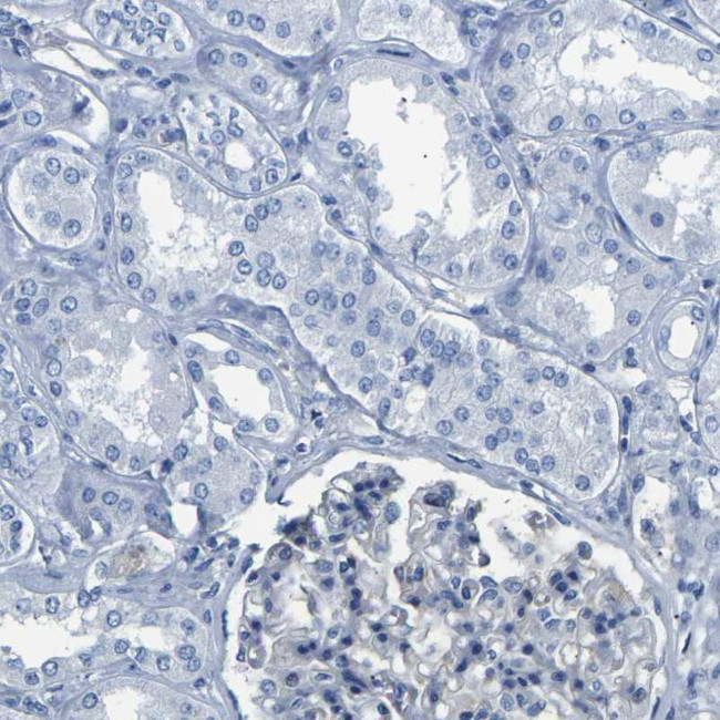 UPK3A Antibody in Immunohistochemistry (IHC)