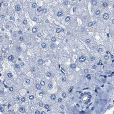 UPK3A Antibody in Immunohistochemistry (IHC)