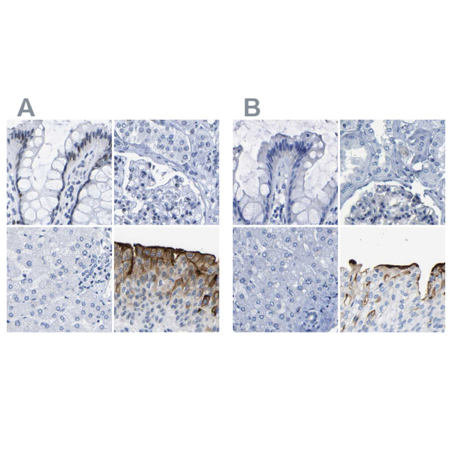 UPK3A Antibody in Immunohistochemistry (IHC)