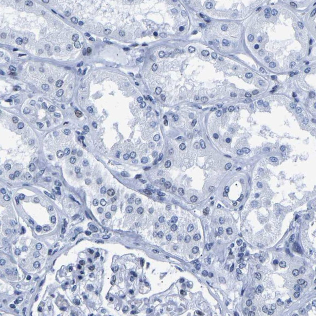 UPK3A Antibody in Immunohistochemistry (IHC)