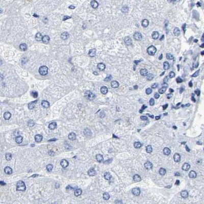 UPK3A Antibody in Immunohistochemistry (IHC)