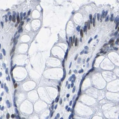 UPK3A Antibody in Immunohistochemistry (IHC)