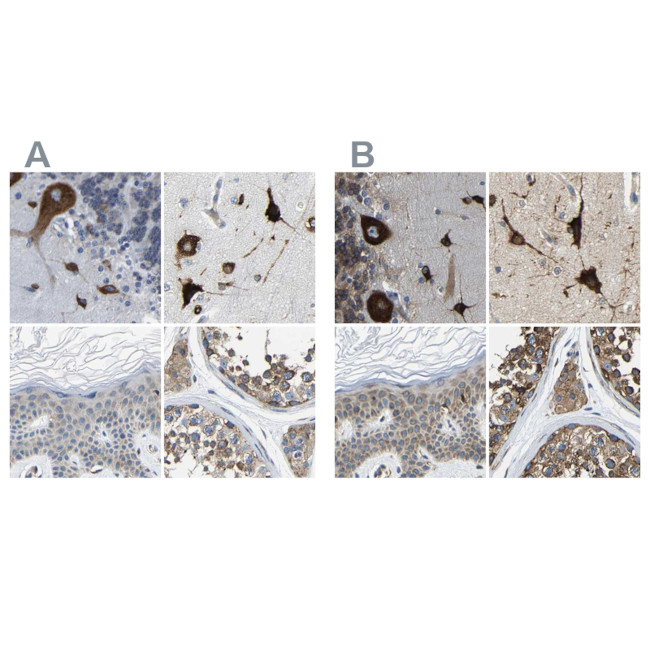 G3BP2 Antibody in Immunohistochemistry (IHC)