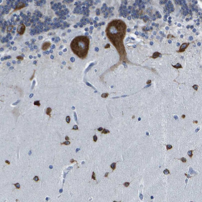 G3BP2 Antibody in Immunohistochemistry (IHC)